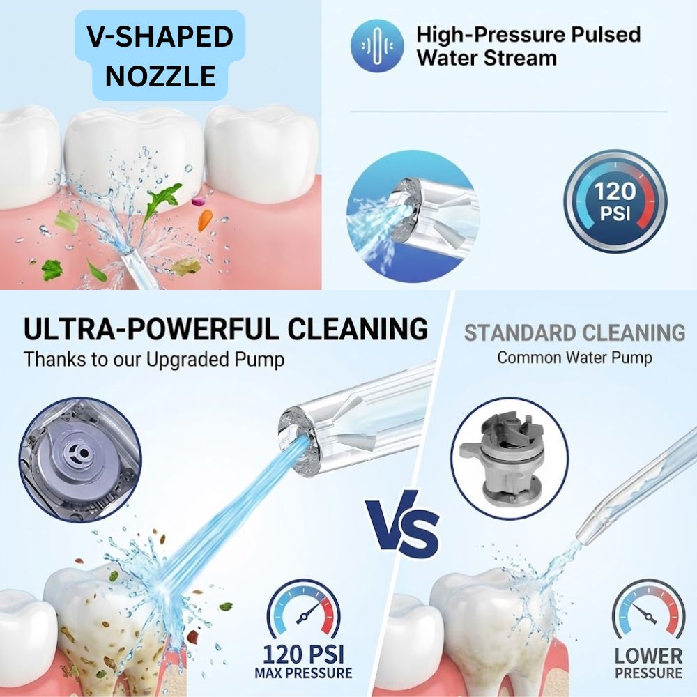 Klenopod UltraClean Water Flosser — Professional Dental Irrigator for Deep & Gentle Oral Care